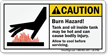 Burn Hazard Hot Tank And Oil Caution Label