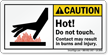 Hot Do Not Touch Result In Burns Label